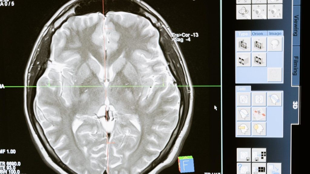 closeup of a brain scan